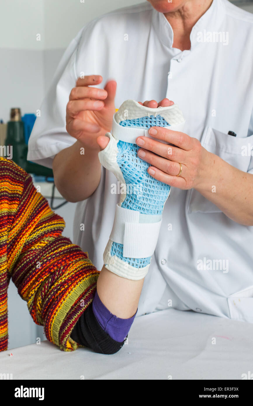 Rheumatoid arthritis hands hires stock photography and images Alamy