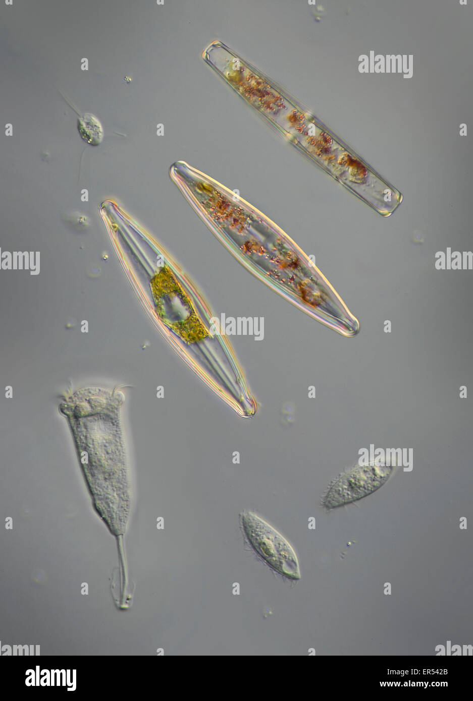 A variety of pondlife, diatoms. protozoa, scuticociliates, a peritrich ciliate -- probably Vorticella, Carchesium Stock Photo