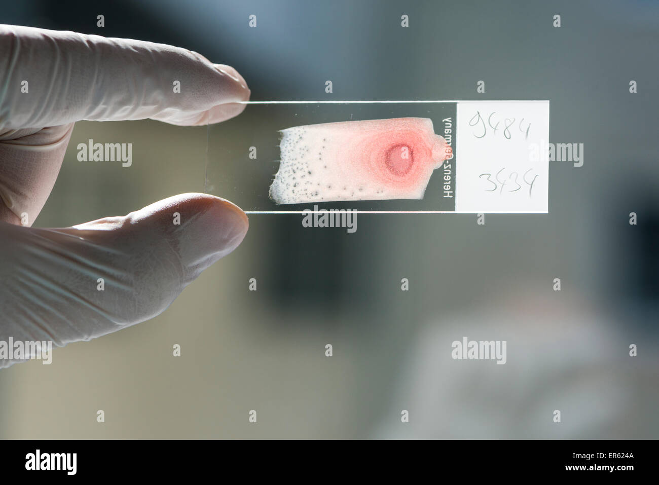 Blood smeared on a glass slide for diagnosis, held against the light in laboratory assistant's hand, Chemnitz, Saxony, Germany Stock Photo