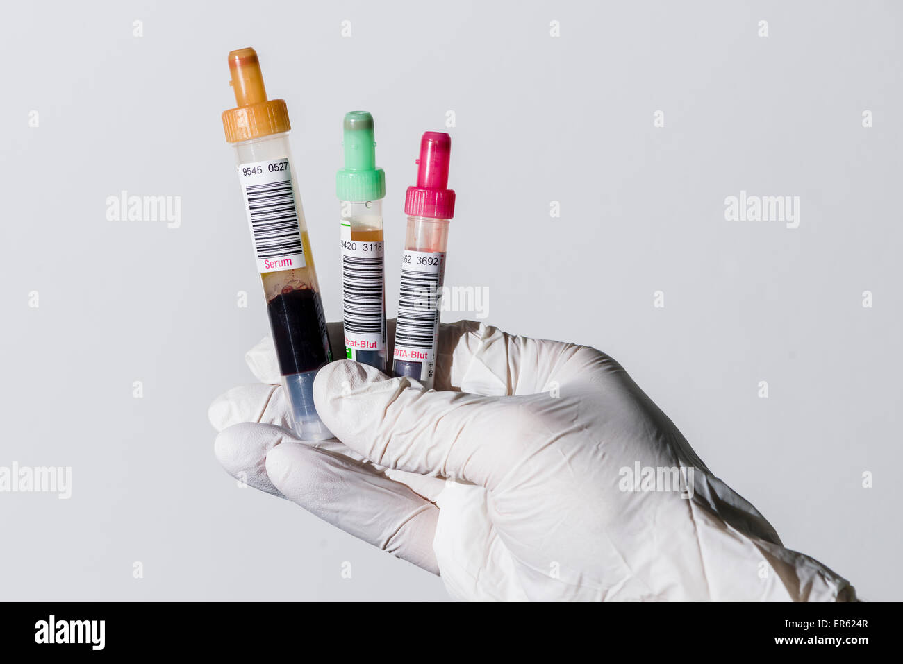 Laboratory assistant's hand holding three monovettes containing serum, citrate and EDTA, Chemnitz, Saxony, Germany Stock Photo