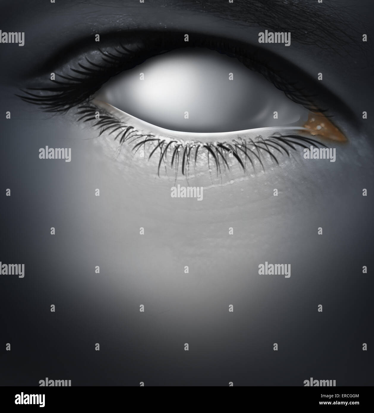 Lost concept and losing memory caused by dementia as alzheimers disease with a blind human eye as a blank white eyeball as a mental health symbol for a psychological crisis of personality and search for direction. Stock Photo