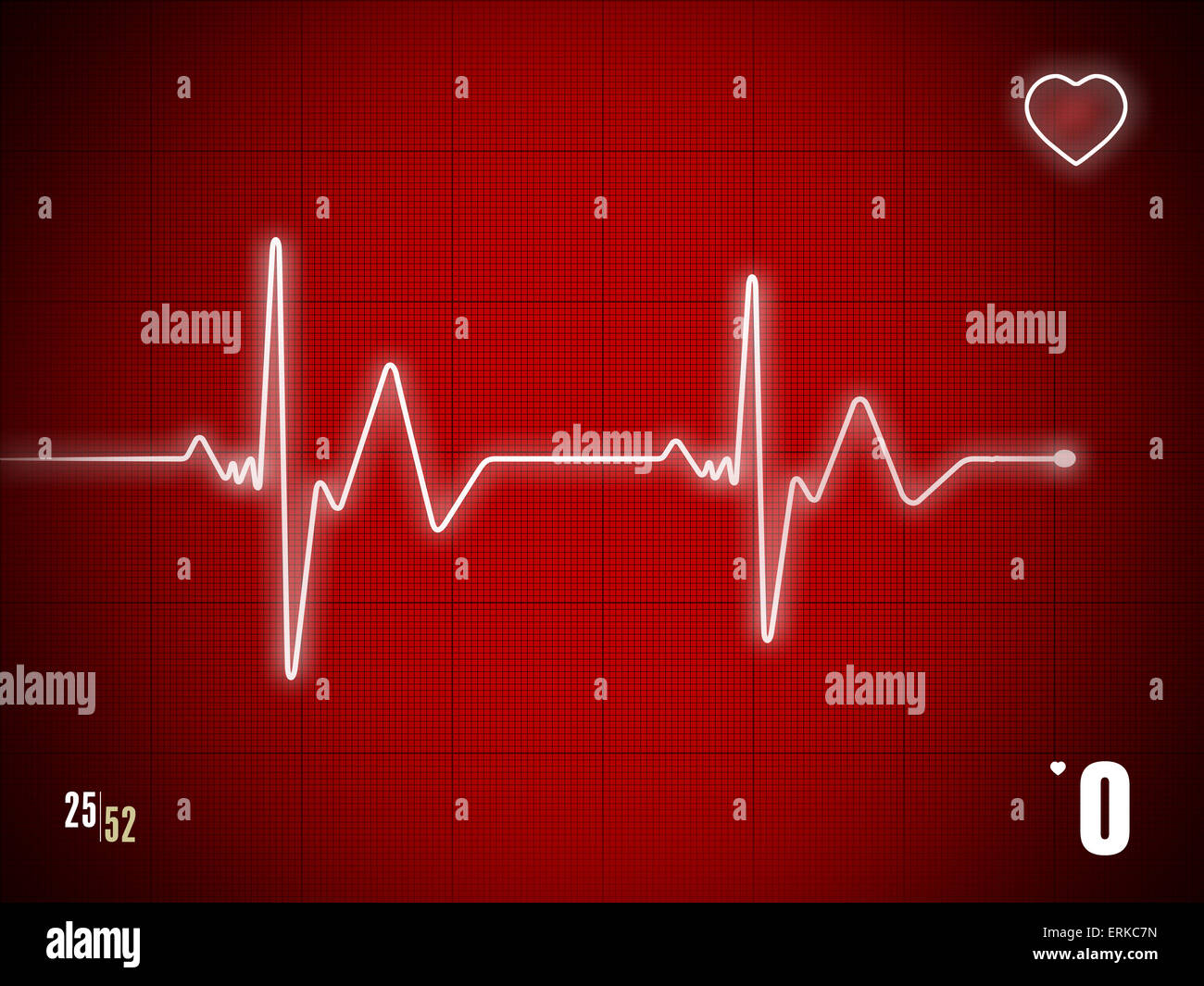 EKG trace showing death moment. Stock Photo