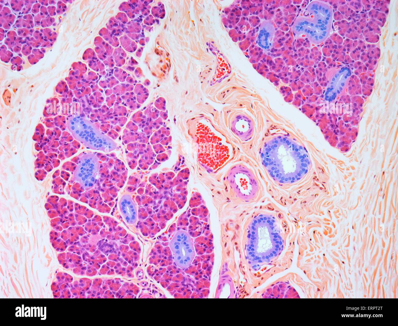 Salivary gland. Coloured light micrograph of a section through a parotid salivary gland. The glands are divided into numerous lobules by stretches of connective tissue (orange). The pink secretory cells produce components of saliva to lubricate the mouth Stock Photo