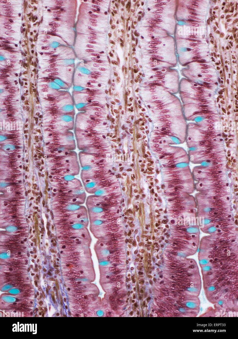 Small intestine. Light micrograph of a section through the finger-like projections (villi) of the duodenum, the uppermost part of the small intestine. These increase the surface area for the absorption of food. Within the columnar epithelium of the outer Stock Photo