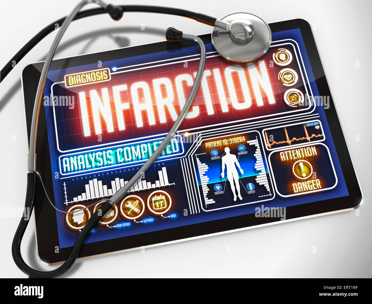Infarction on the Display of Medical Tablet. Stock Photo
