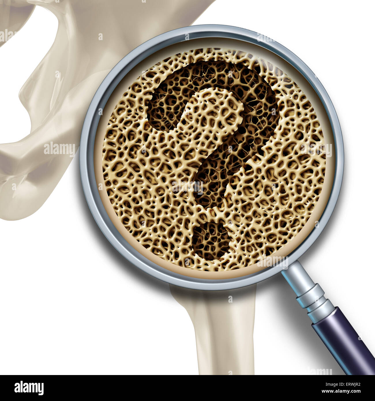 Bone medical health questions and osteoporosis illustration concept as a close up diagram of the inside of human skeletal hip bones with a magnification glass showing a normal healthy condition degrading to abnormal unhealthy anatomy as a question mark. Stock Photo