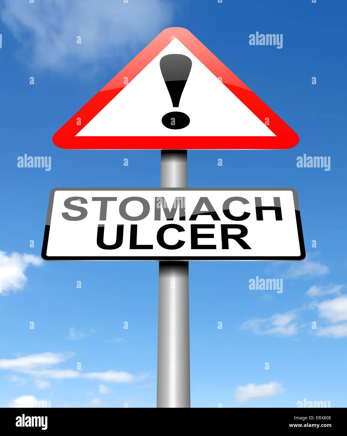 Stomach ulcer concept. Stock Photo