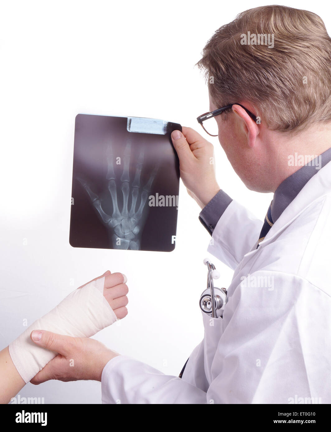 Broken hand x ray hi-res stock photography and images - Alamy