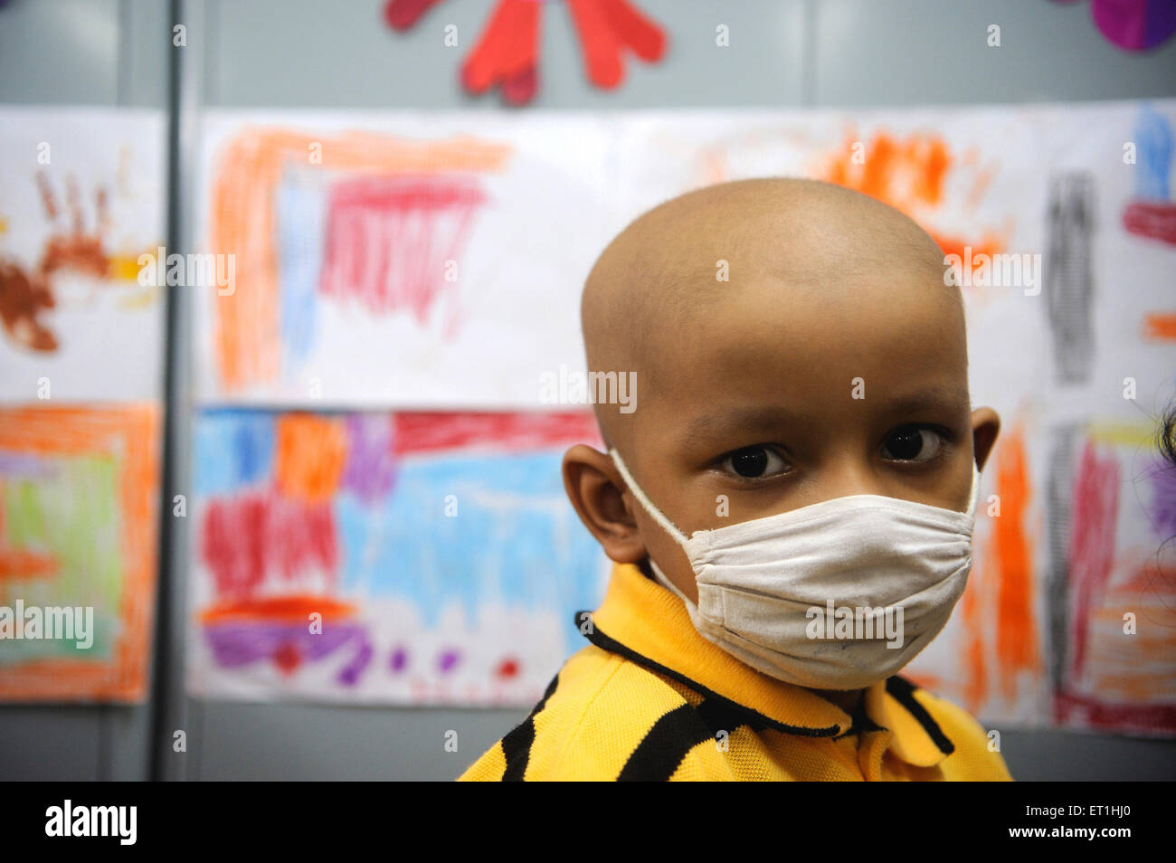 Cancer infected child wearing mask ; Bombay ; Mumbai ; Maharashtra ;  India - No Model Release -  only for editorial use Stock Photo