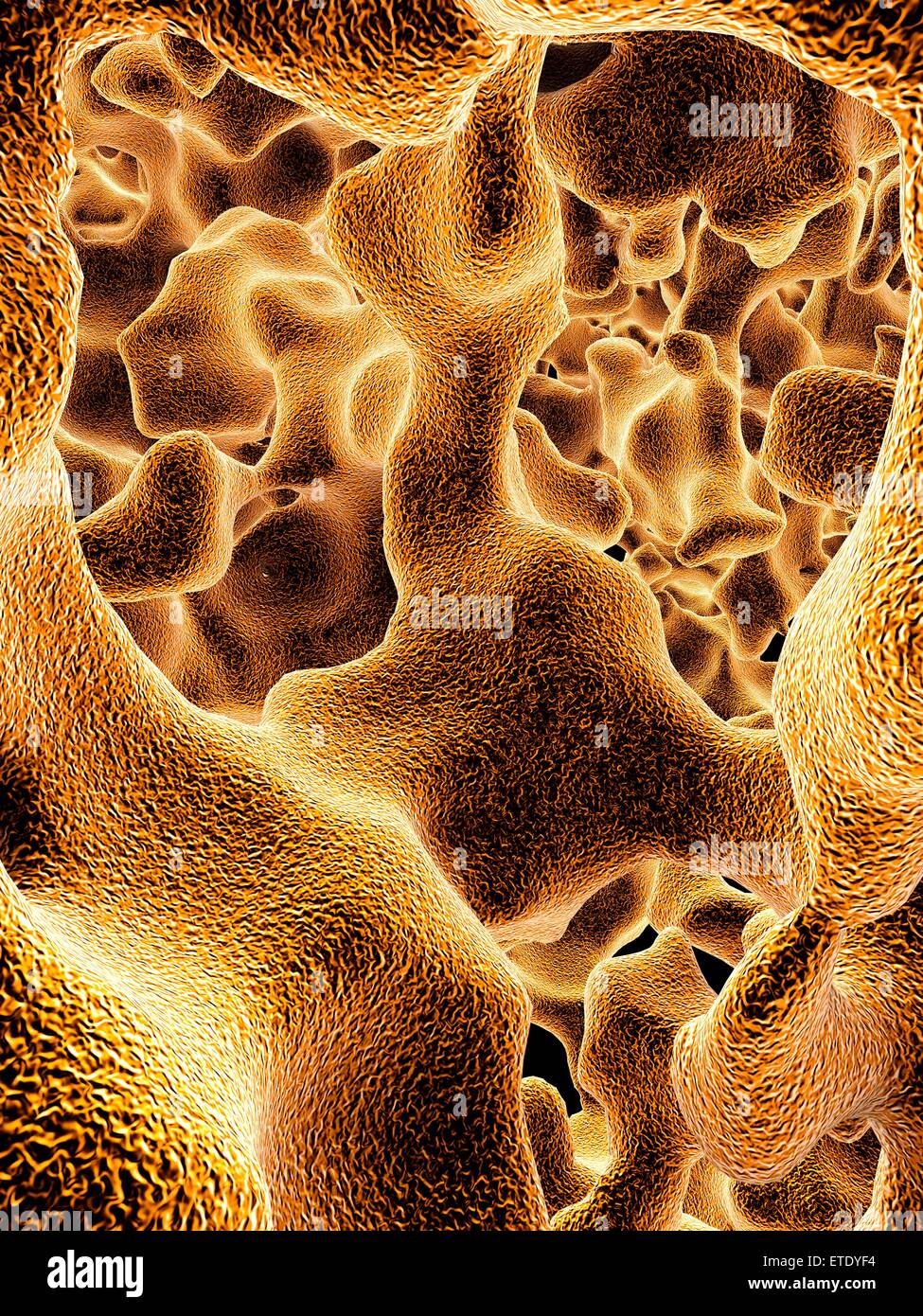Osteoporosis. Computer artwork of the trabeculae in the cancellous