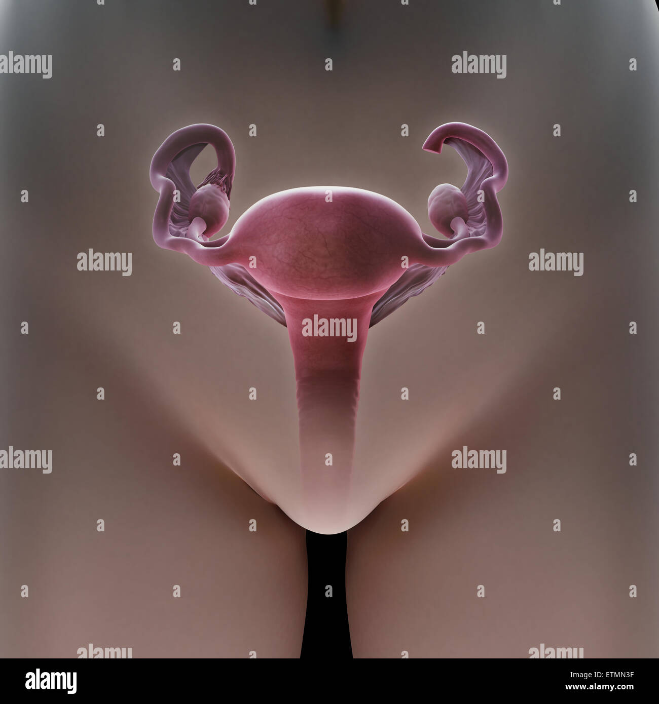 Biomedical illustration tubectomy tubectomy fallopian hires stock