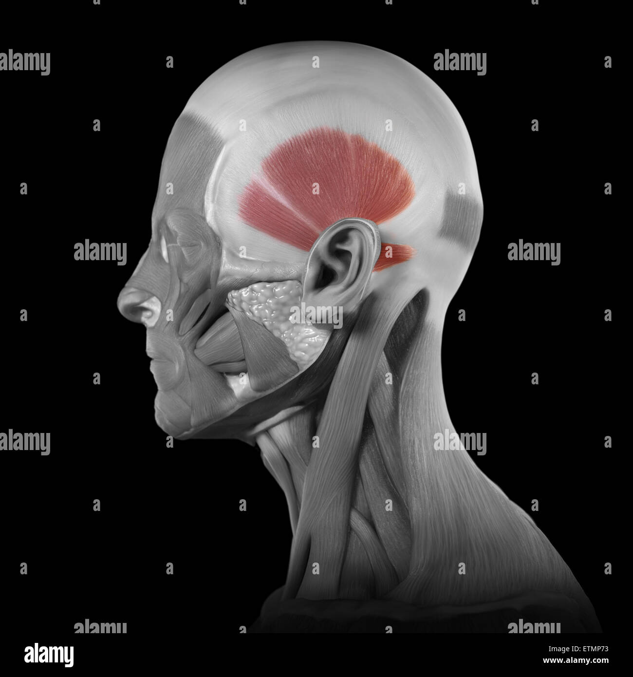 Conceptual image of the muscles of the face with the temporalis muscles highlighted. Stock Photo