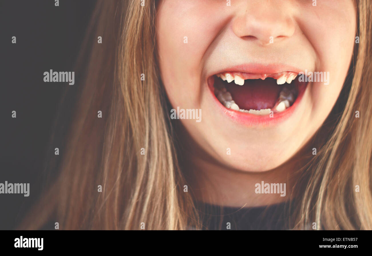 Close-up of a gap toothed girl laughing Stock Photo