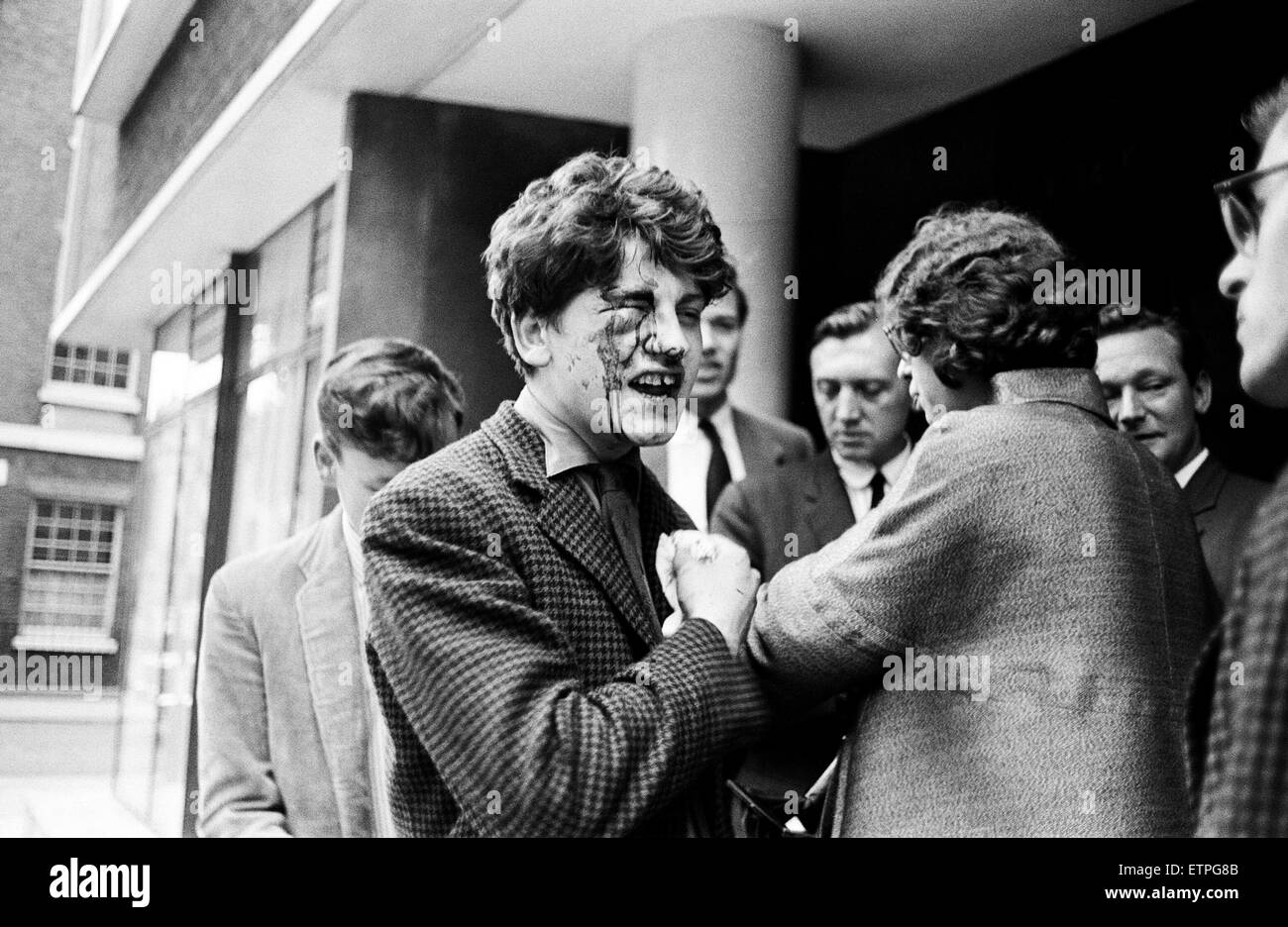 A 'Bloody' angry Empire Loyalist... 17 year old William Baillie after a punch up with members of the Committee of 100 at a peace meeting in the Mahatma Gandhi Hall in Fitzroy Street, London. 20th July 1962. Stock Photo