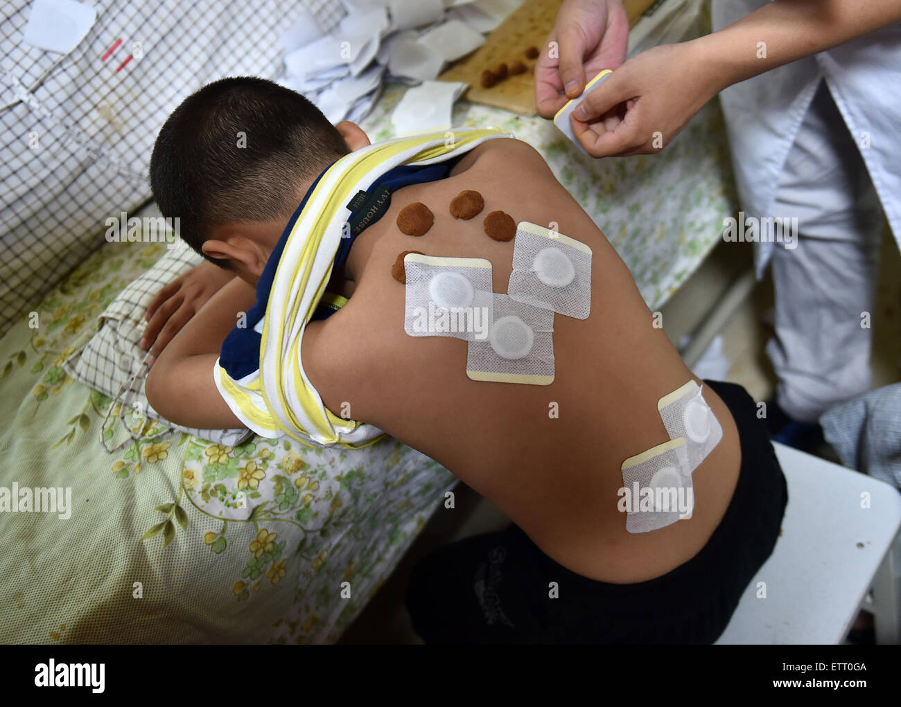 Acupoints hi-res stock photography and images - Alamy