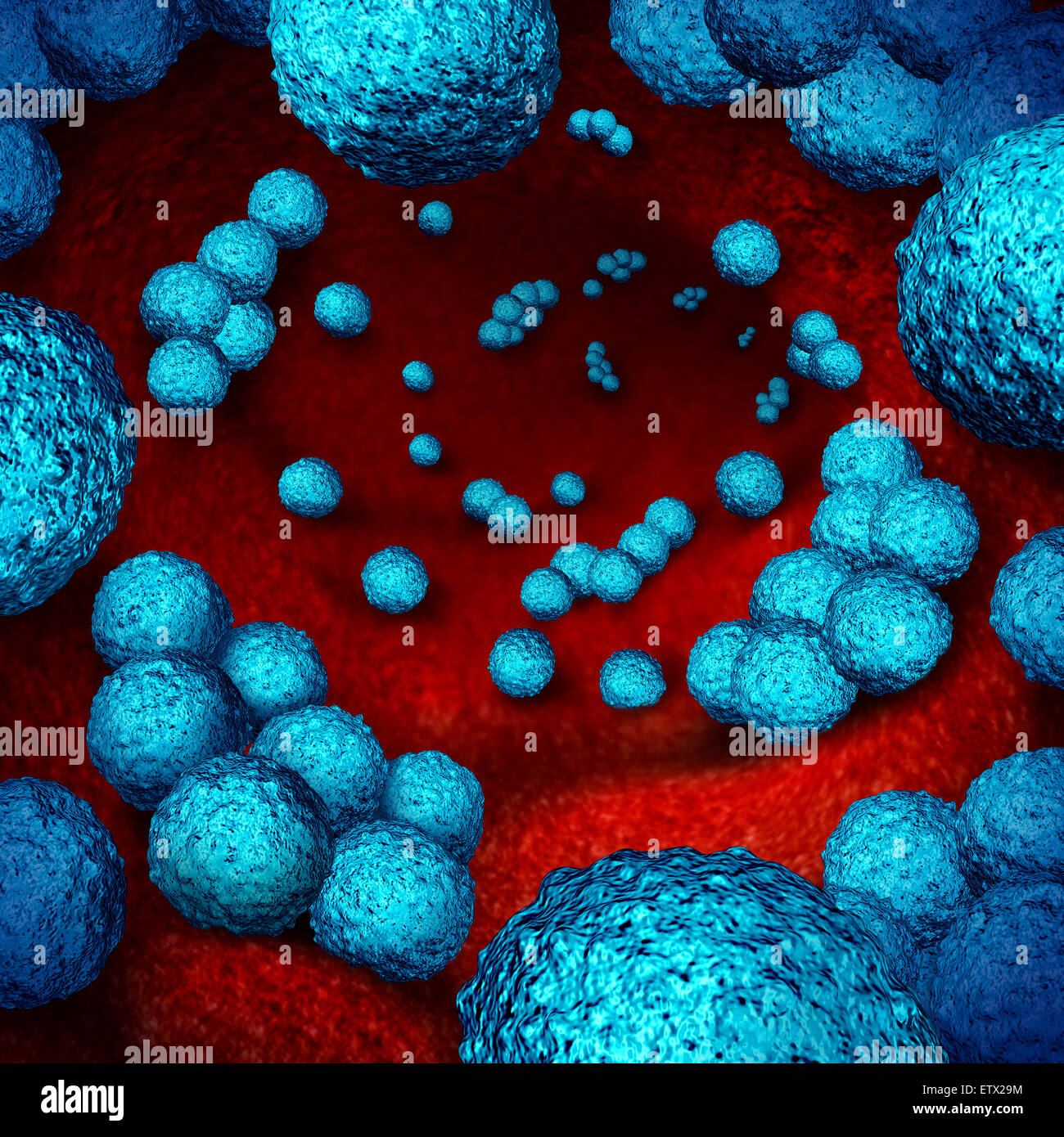 Superbug bacteria or MRSA medical healthcare concept and antimicrobial resistance health risk symbol as a three dimensional illustration of bacterium infection inside the human body as an icon of multidrug resistant microscopic organisms. Stock Photo