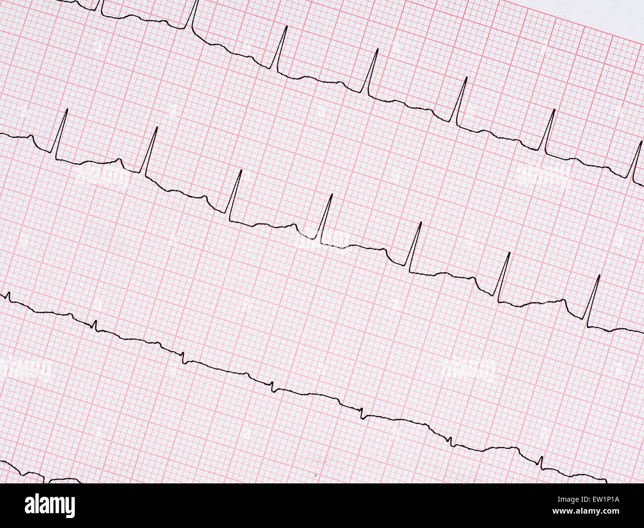 Healthy heart etc. Genuine electrocardiogram ecg printout detail. Stock Photo