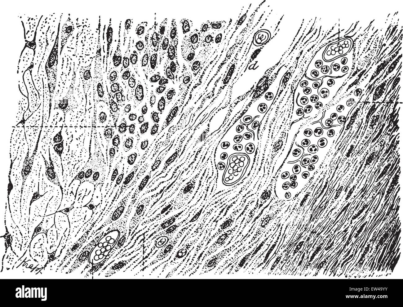 Granular tissue, vintage engraved illustration. Stock Vector