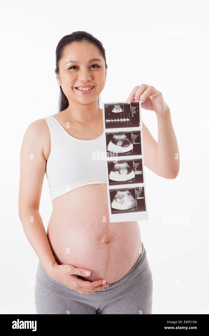 Pregnant woman holding x-ray images and smiling at the camera, Stock Photo