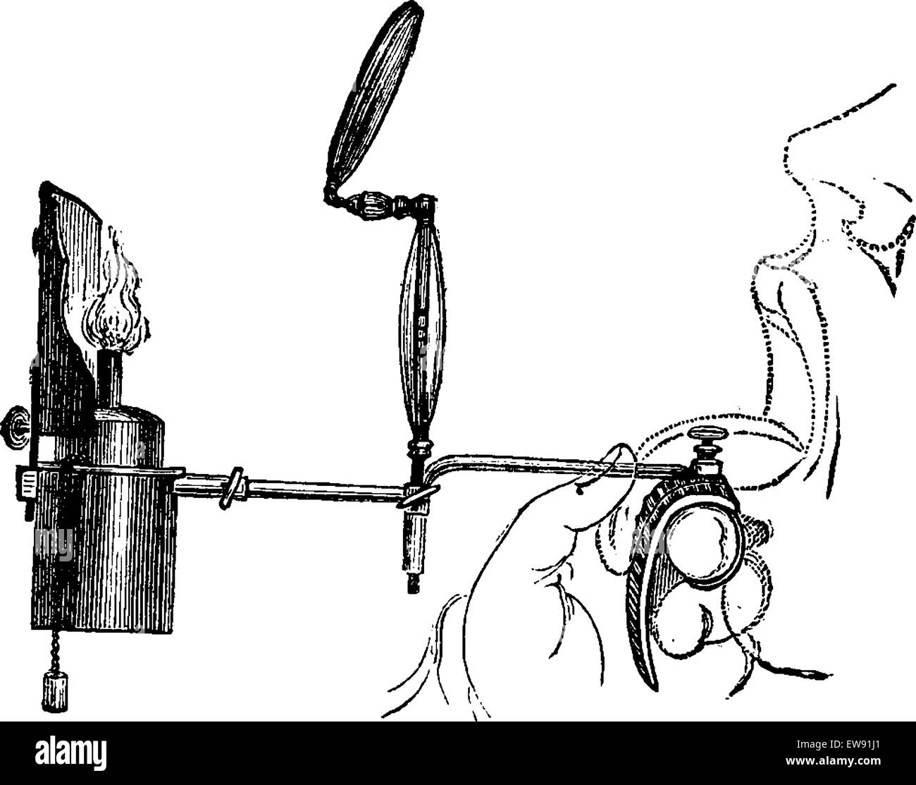 Portable Laryngoscope, illuminated by direct light from a gas lamp, used to examine a patient's mouth, vintage engraved illustra Stock Vector