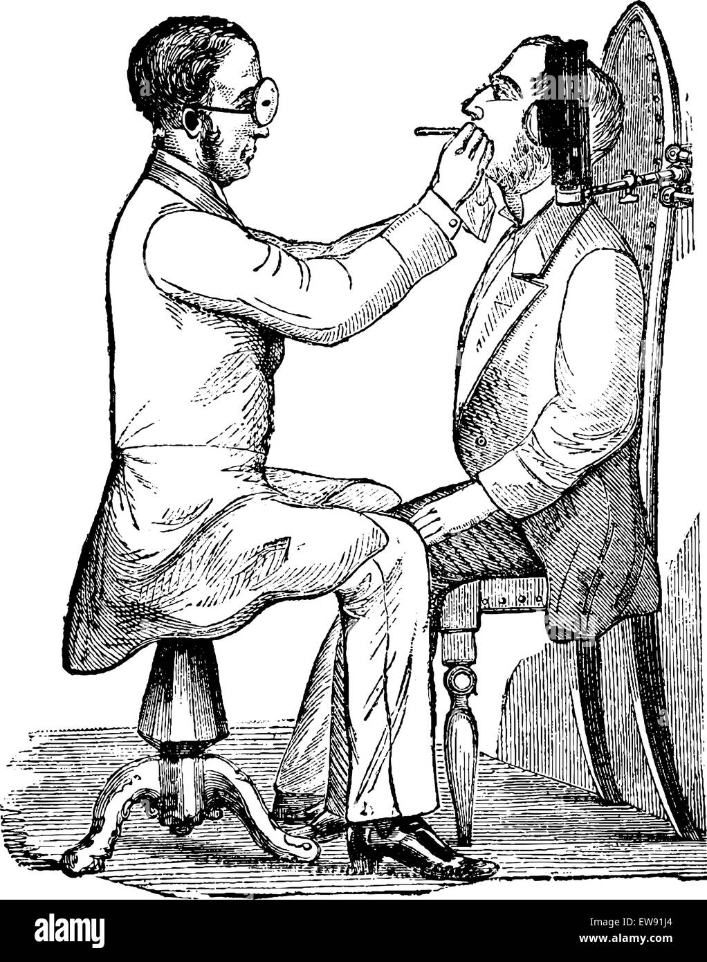 Laryngoscopy, showing a doctor looking into a patient's mouth, illuminated by indirect light from a gas lamp, vintage engraved i Stock Vector