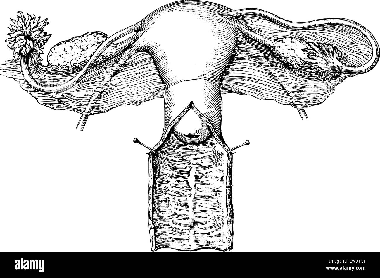 Internal genitals of women, vintage engraved illustration. Usual Medicine Dictionary - Paul Labarthe - 1885. Stock Vector