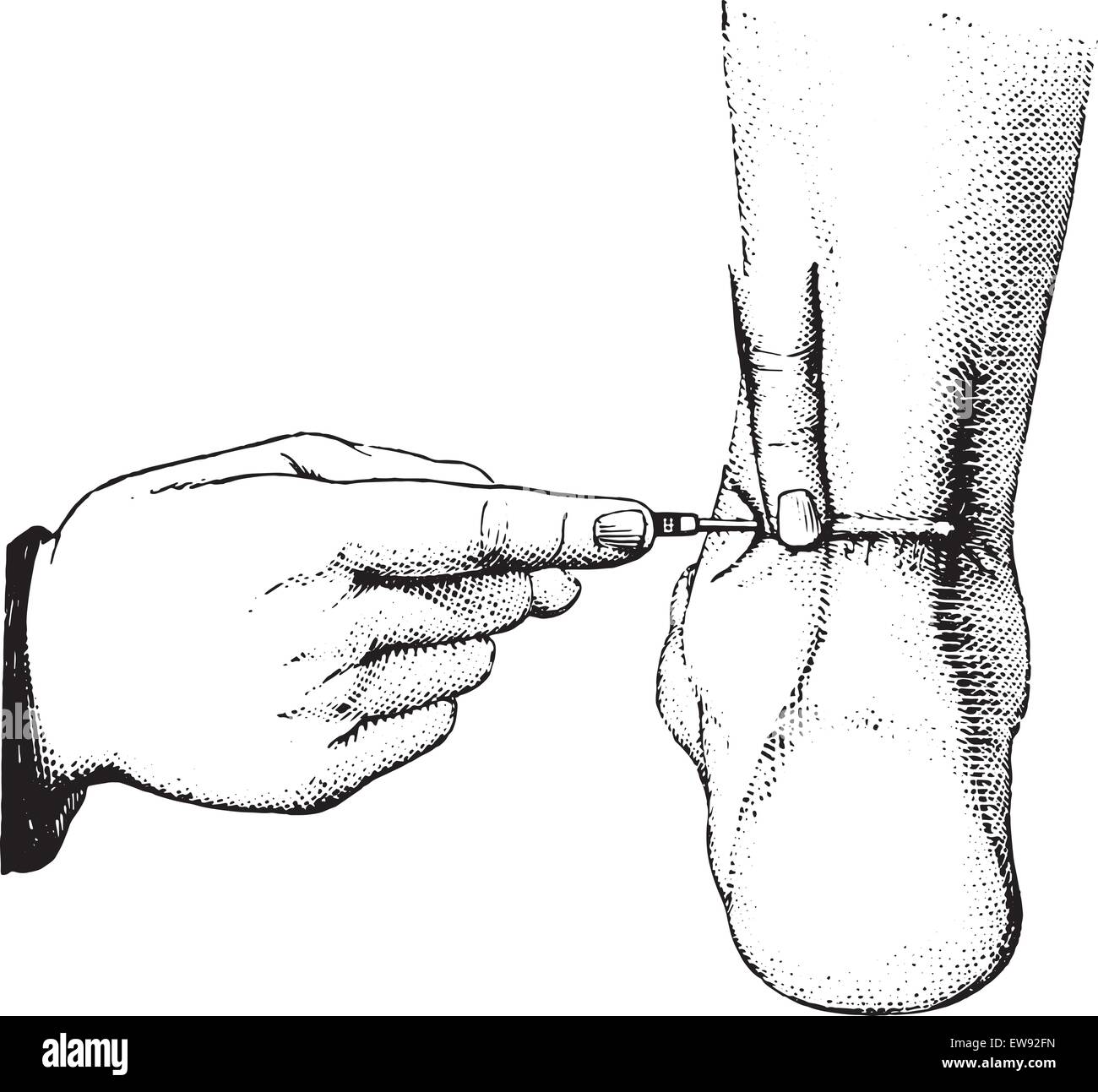 Achilles tendon hires stock photography and images Alamy