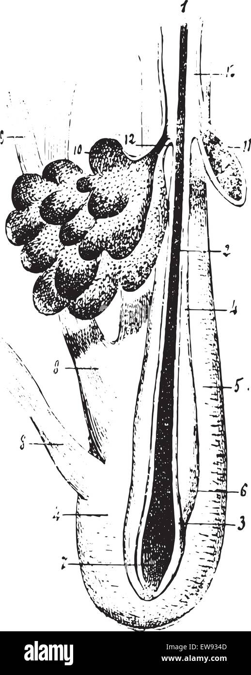 Hair follicles with sebaceous glands and smooth muscle fibers, vintage engraved illustration. Usual Medicine Dictionary by Dr La Stock Vector