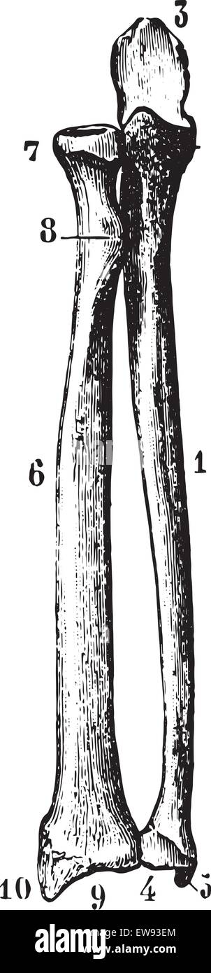 Radius and ulna (bones of the forearm) seen by their front face, vintage engraved illustration. Usual Medicine Dictionary by Dr  Stock Vector