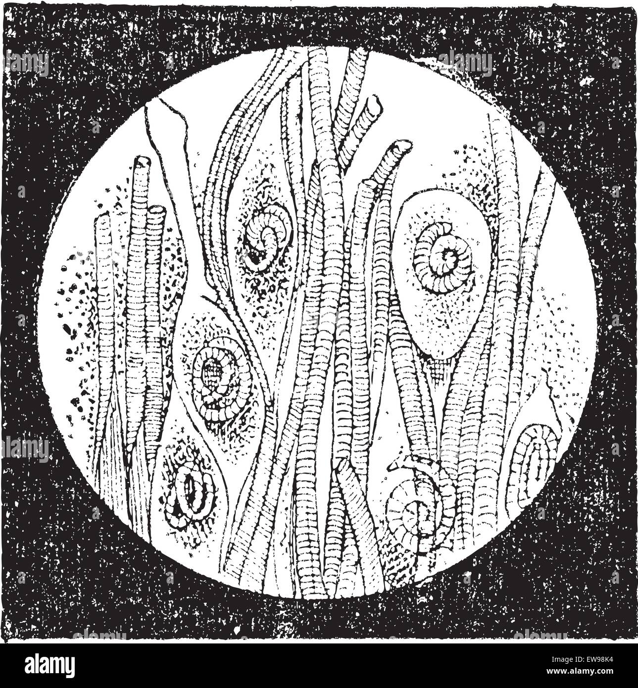 Trichinella or trichina worms, vintage engraved illustration. Dictionary of words and things - Larive and Fleury - 1895. Stock Vector