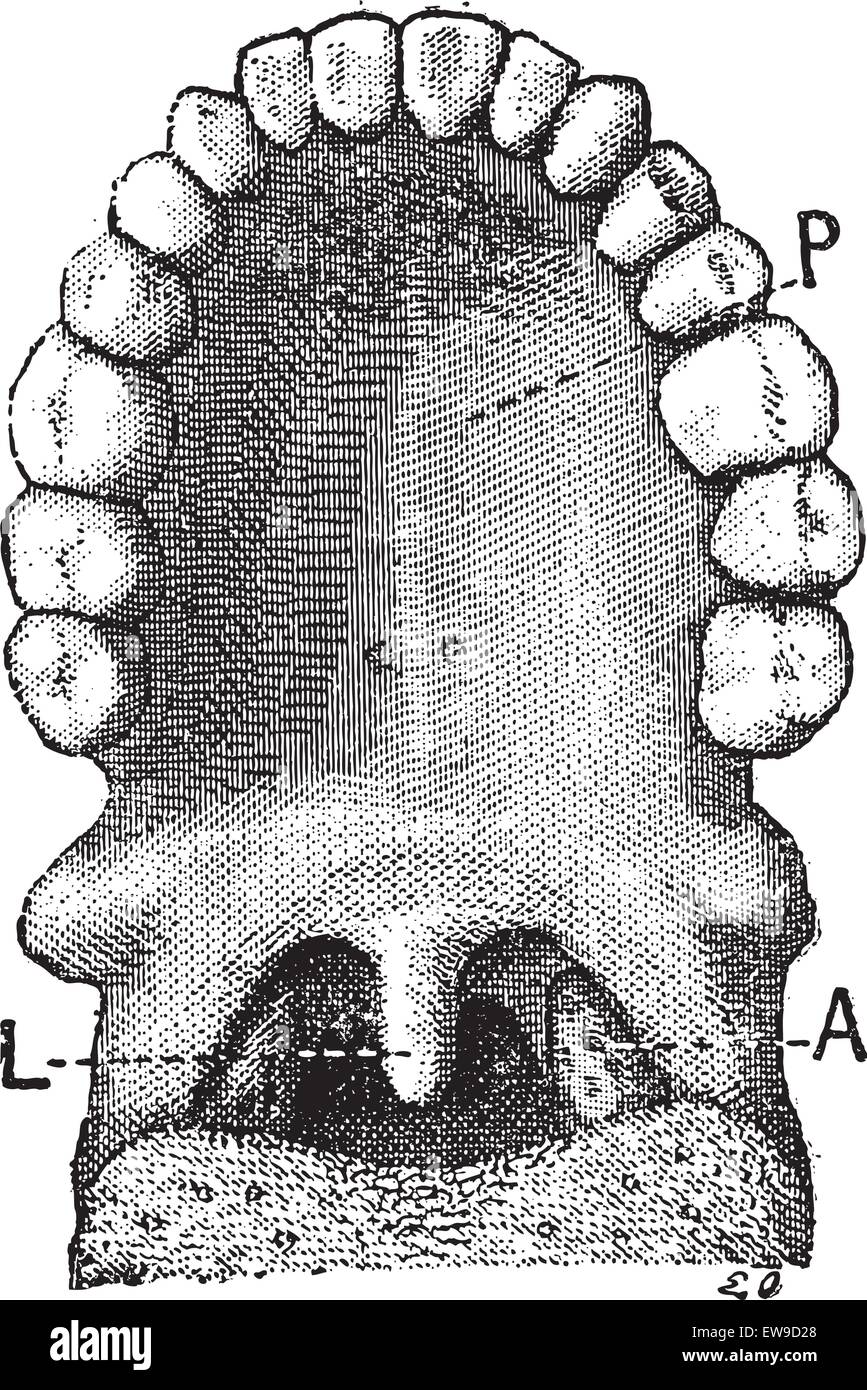 The palatine uvula or uvula, vintage engraved illustration. Dictionary of words and things - Larive and Fleury - 1895. Stock Vector