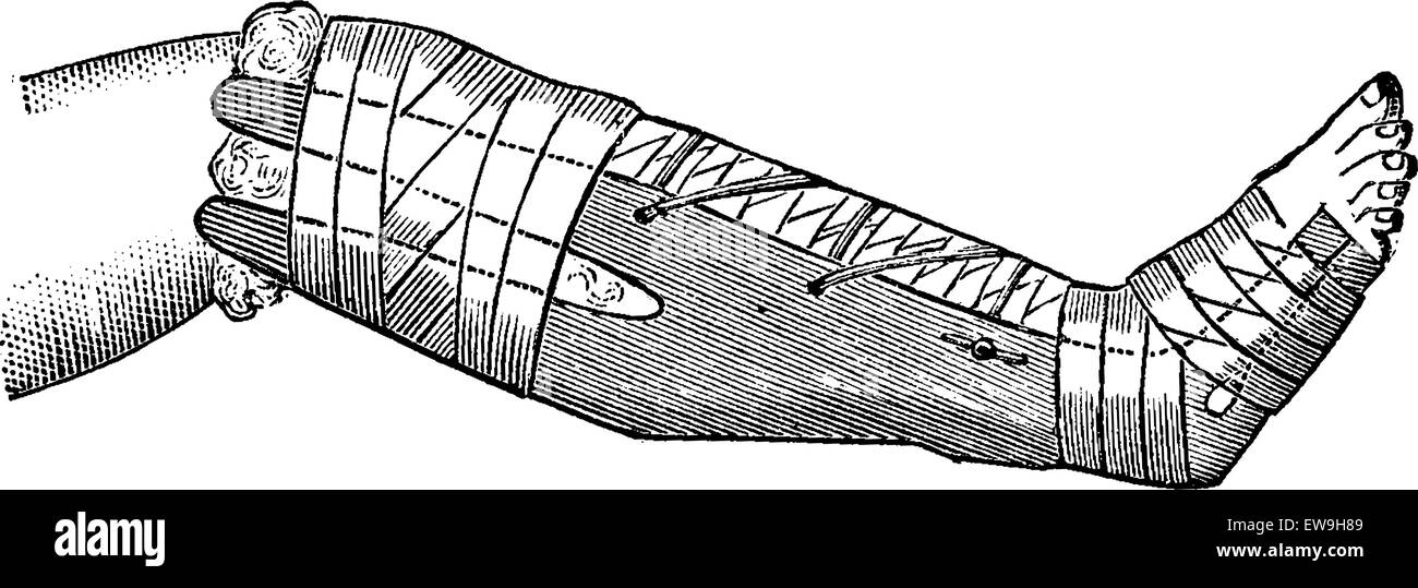 Bandage dictionary on sale