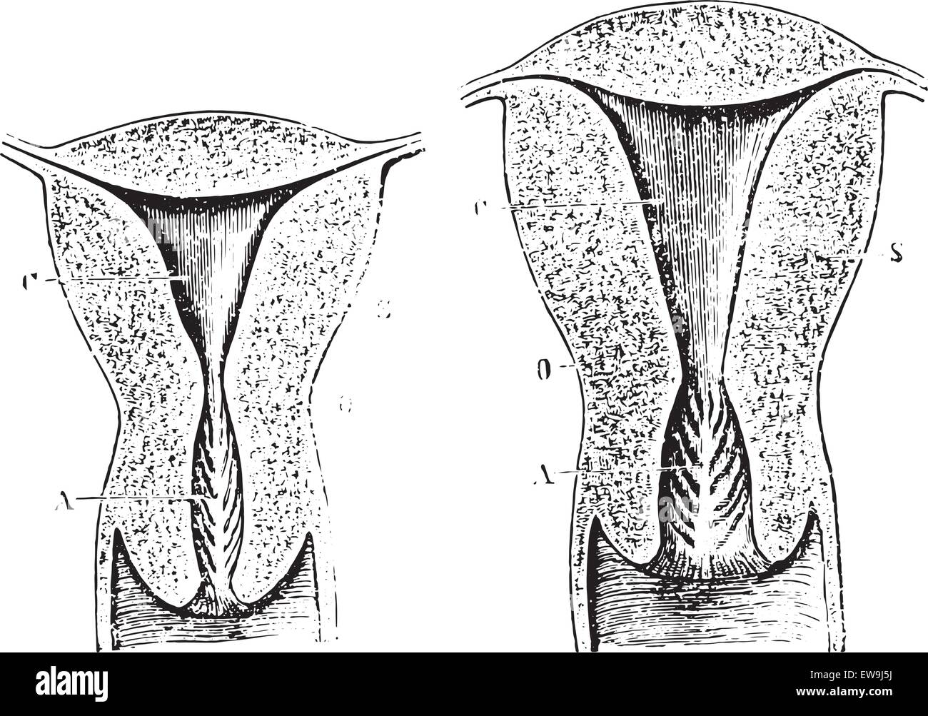 Section of a virgin womb Cup, vintage engraved illustration. Usual Medicine Dictionary by Dr Labarthe - 1885. Stock Vector