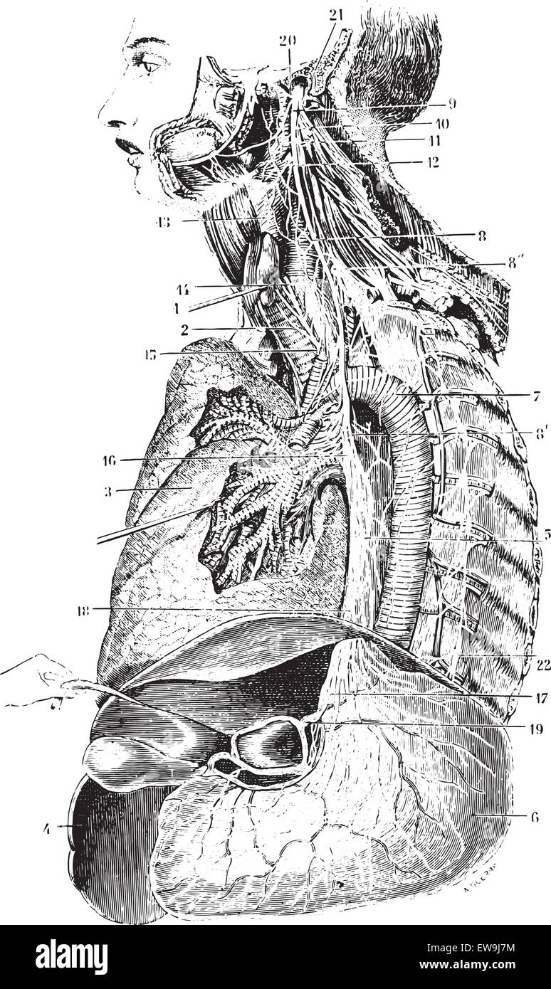Left Vagus nerve or Pneumogastric nerve or Cranial nerve X, vintage engraved illustration. Usual Medicine Dictionary by Dr Labar Stock Vector