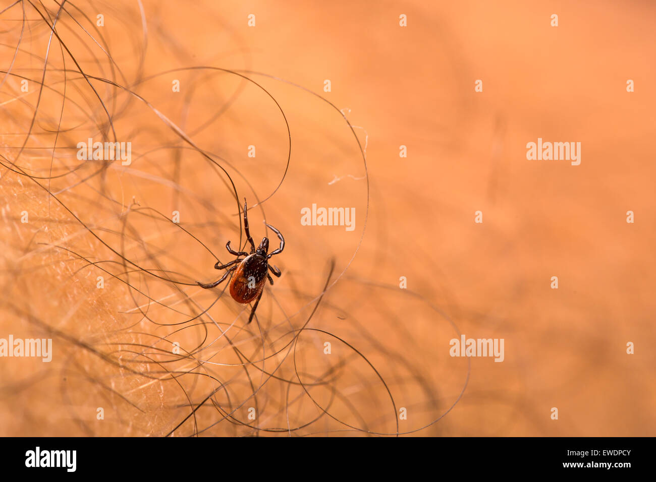Tick - parasitic arachnid blood-sucking carrier of various diseases ...