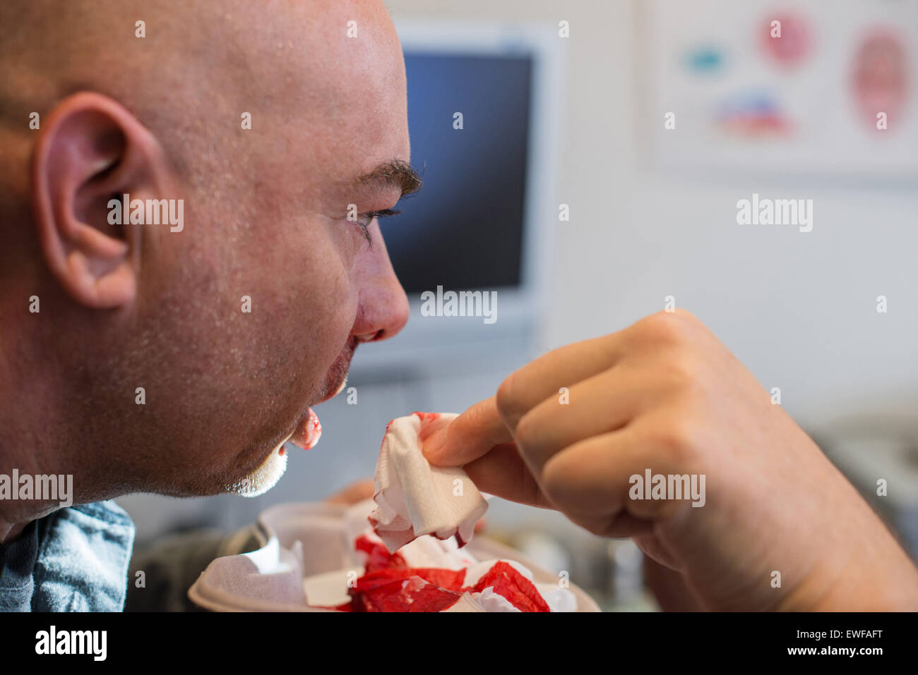 What excellent Adult nose bleed opinion you Adult nose bleed me, please