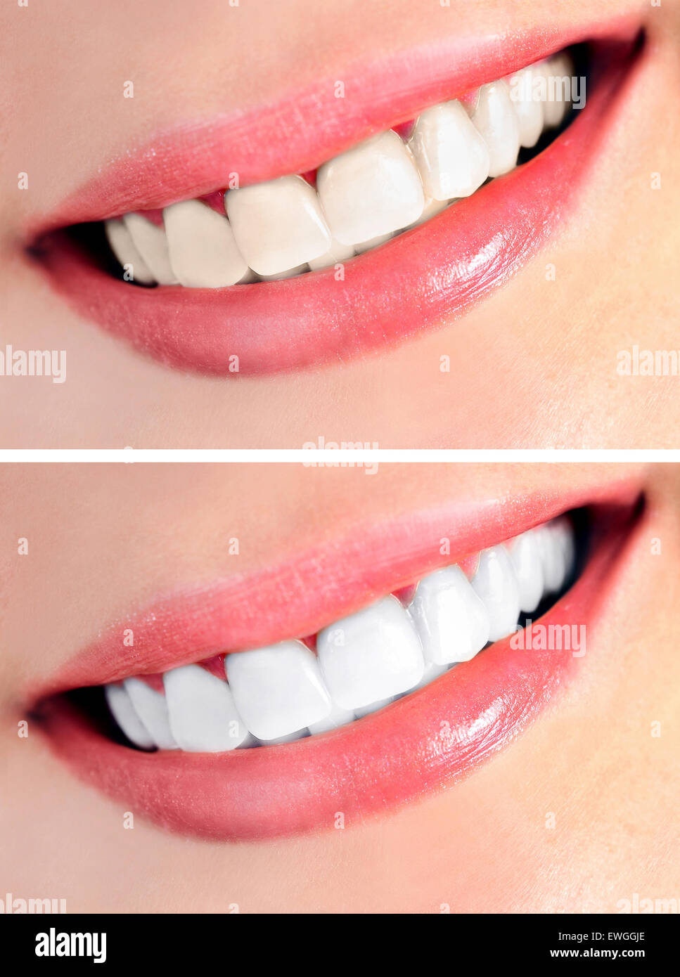 Healthy teeth and smile Stock Photo