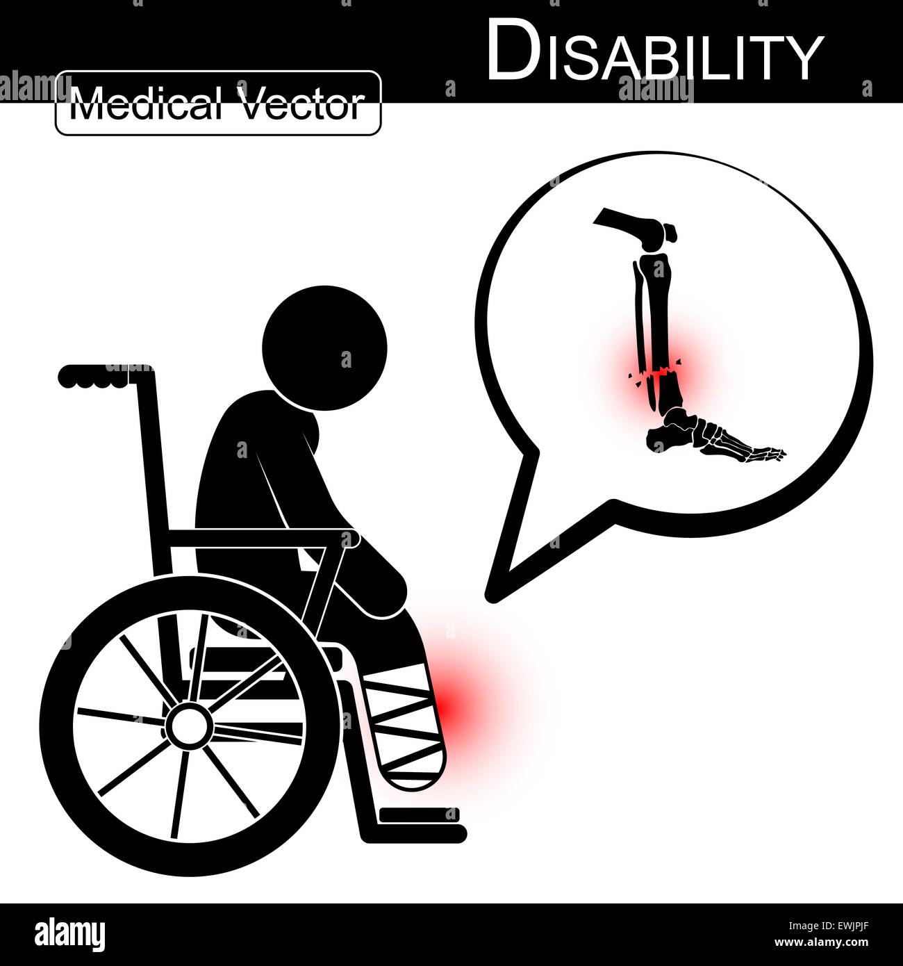 Vector Stick man with leg fracture on wheelchair and text bubble ( Disability , Physical Therapy concept ) ( Flat design ) ( Tib Stock Photo