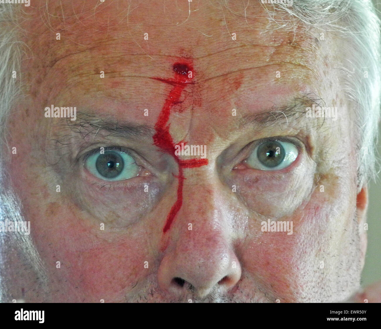 Shot bullet wound to head bleeding shooting injury firearm - MODEL RELEASE RELEASED Stock Photo