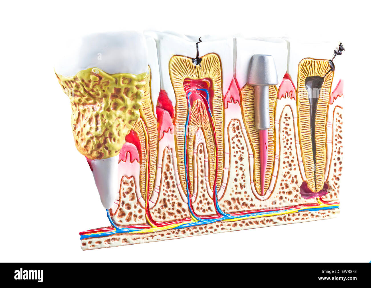 Dental section model, teeth anatomic background. Stock Photo