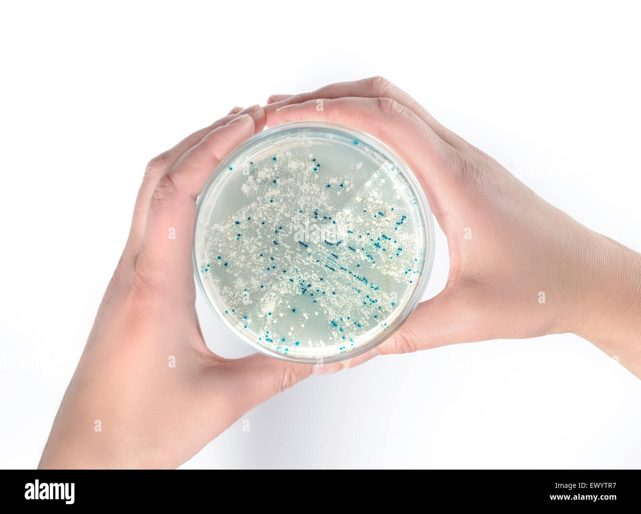 Hands holding agar plate with bacterial colonies for plasmid vector cloning Stock Photo