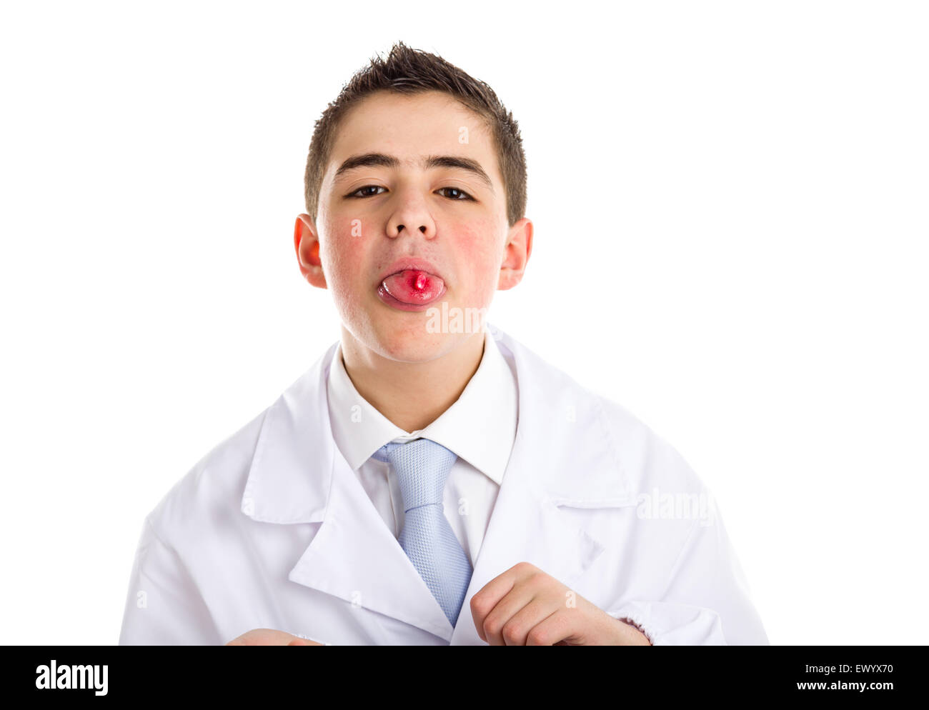 Boy dressed as a doctor in light blue tie and white coat helps to feel medicine more friendly: he is showing his tongue with a pill on it. His acne skin has not ben retouched Stock Photo