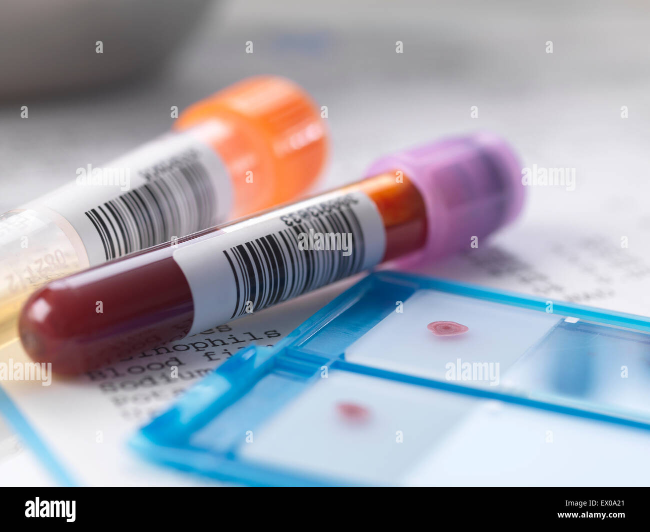 Blood and urine samples with medical results Stock Photo