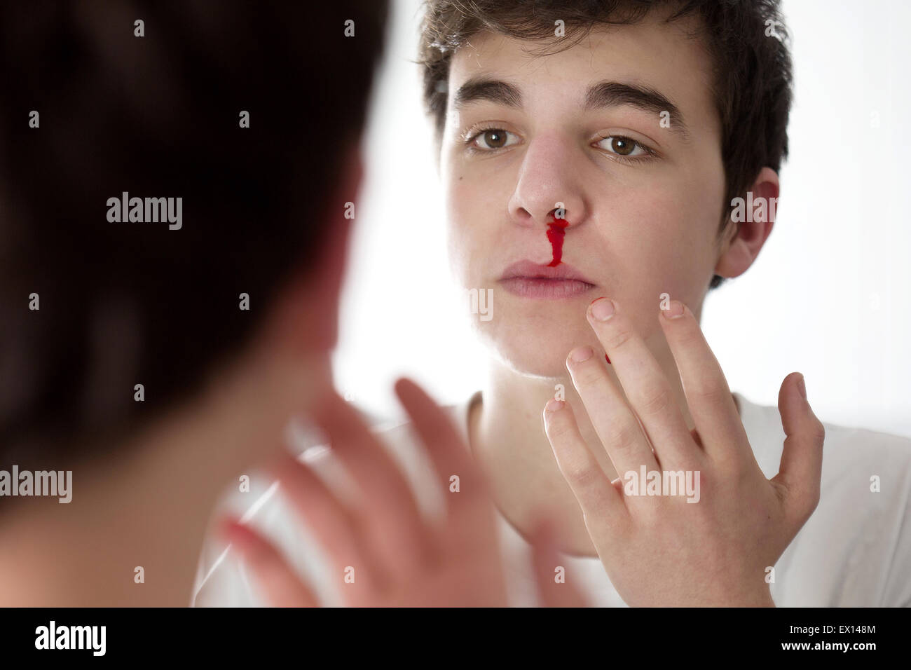 Bleeding nose hires stock photography and images Alamy