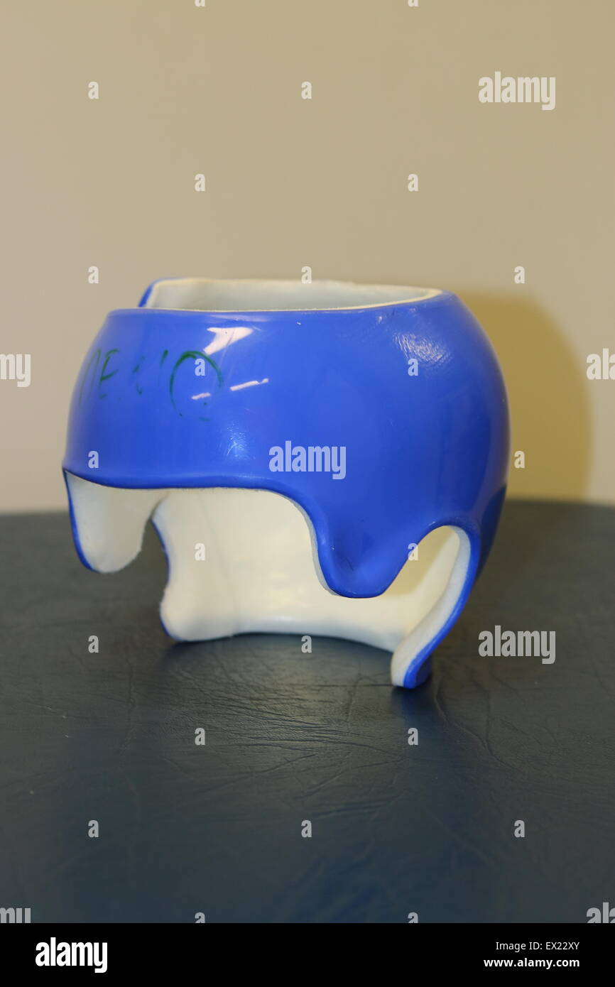 Helmet for Plagiocephaly (Flat head syndrome Stock Photo - Alamy