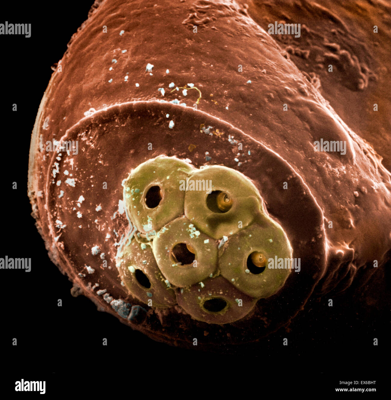 Pediculus humanus capitis, head louse egg detail, SEM Stock Photo