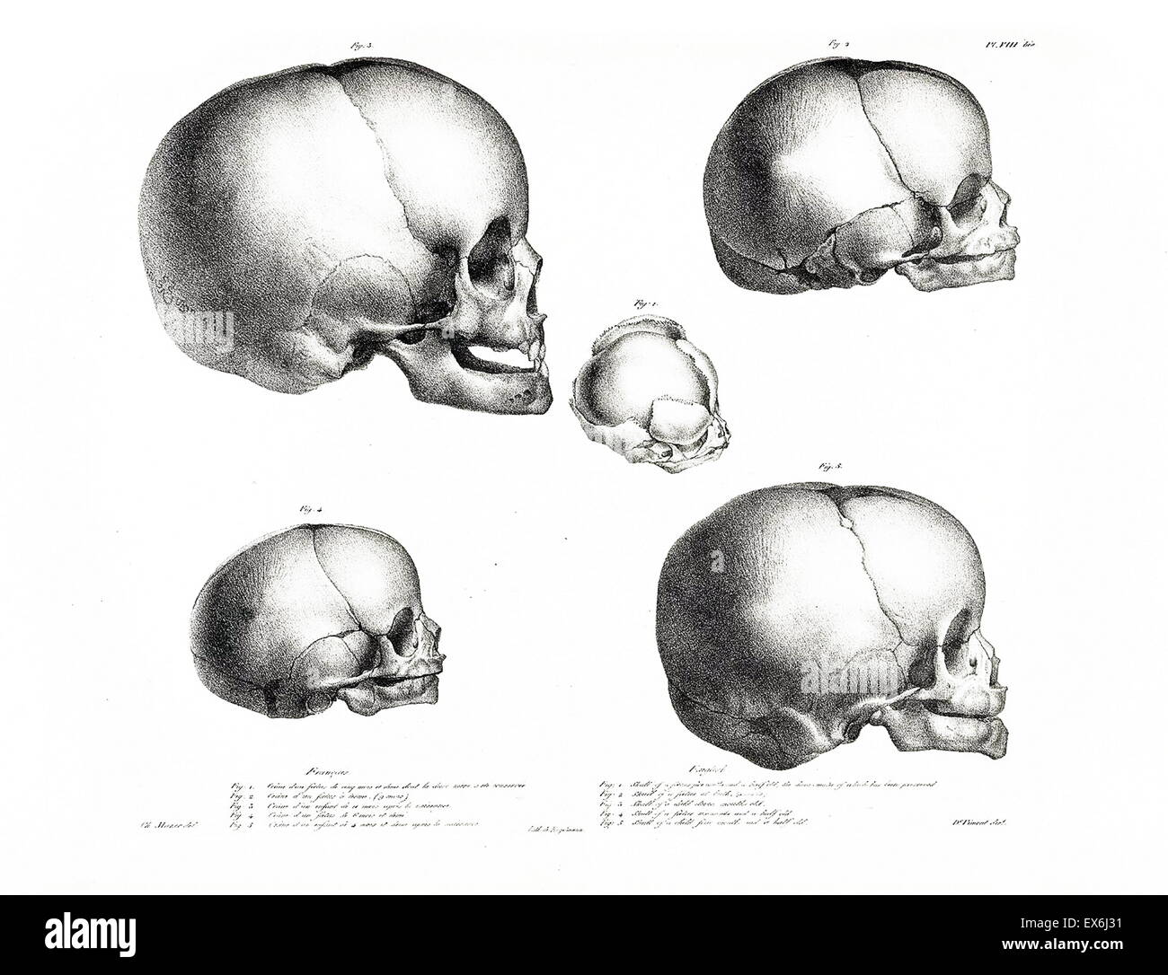 illustration from 'Traitè de phrénologie humaine et comparée (Paris, 1832-1835); by Joseph Vimont 1795 - 1857. phrenology was founded in the early 19th century by Franz Josef Gall (1758-1828). It holds that different intelligences and personality traits h Stock Photo