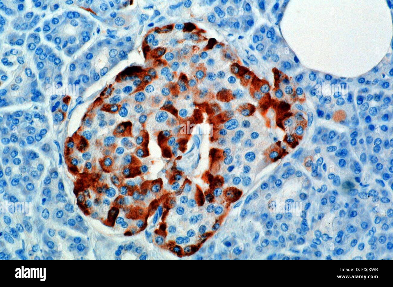 Glucagon: Immunoperoxidase staining of normal formalin-fixed, paraffin-embedded, mouse pancreas showing cytoplasm staining of islet alpha cells. Stock Photo