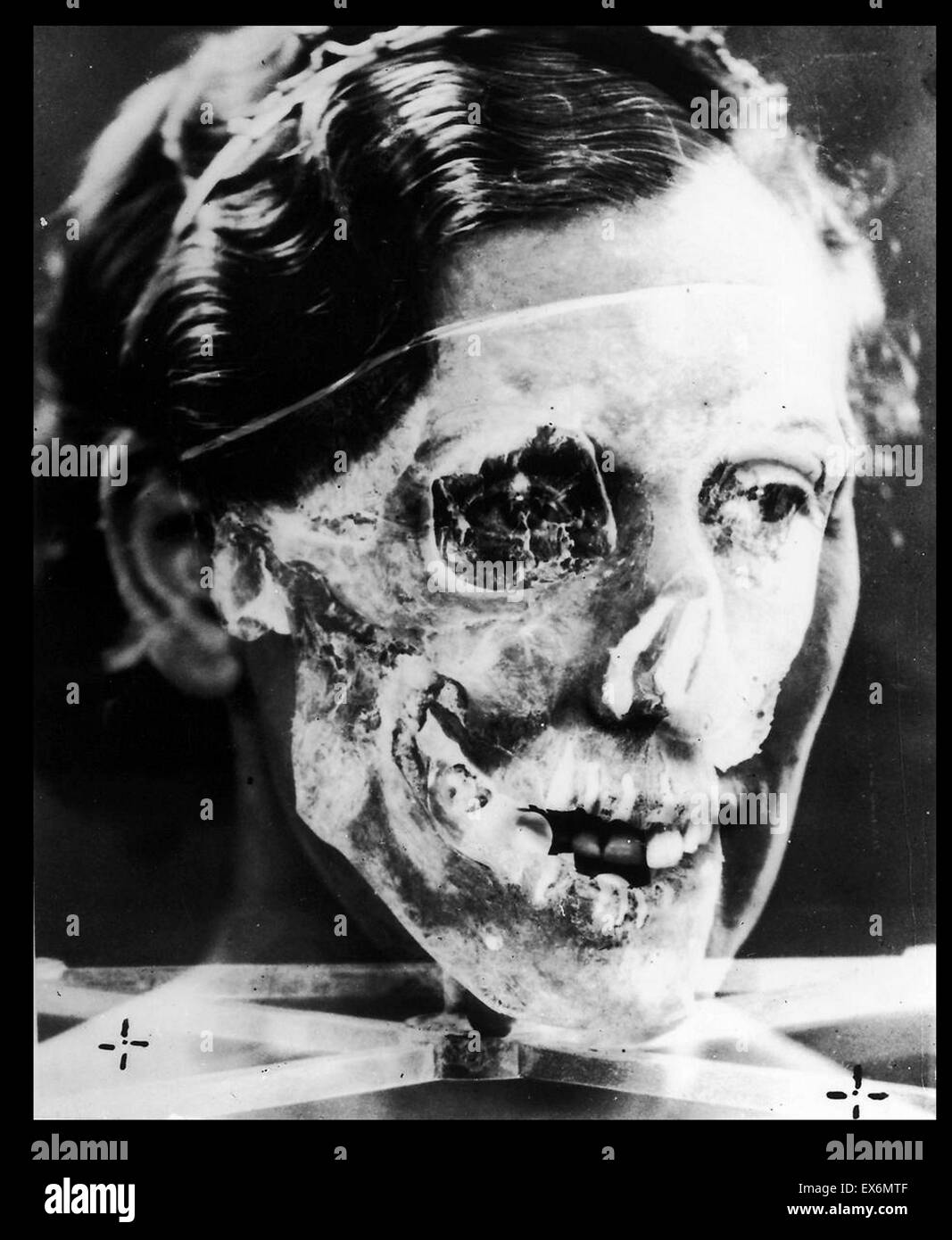 Superimposed photographs, Mrs. Ruxton and skull no.2, 1935 Stock Photo