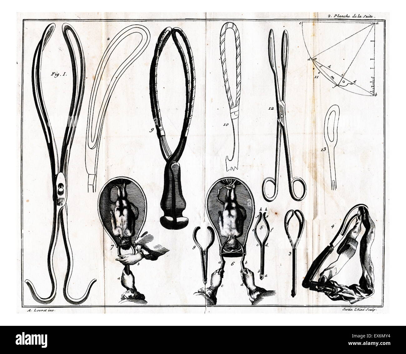 Obstetrical forceps. From André Levret's Observations sur les causes et les accidens de plusieurs accouchemens laborieux, 1754 Stock Photo